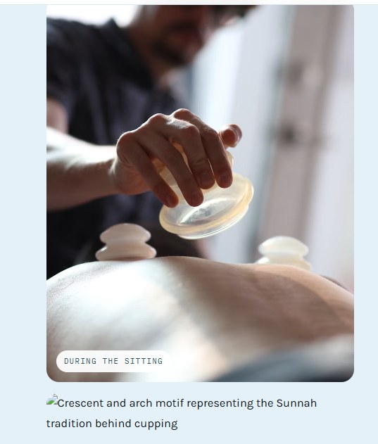 Cups placed along a client&rsquo;s back during a hijama session